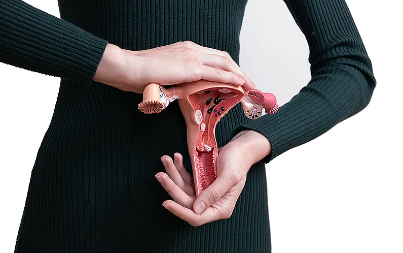 สาเหตุของโรค pcos ฮอร์โมนแอนโดรเจนสูง มีภาวะดื้อต่ออินซูลิน