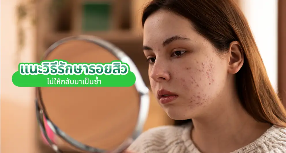 รักษารอยสิว