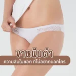 ขาหนีบดำ