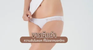 ขาหนีบดำ