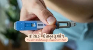 เทรนด์ ปักพุงคุมหิว